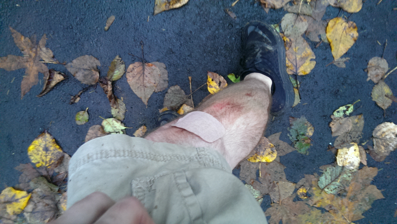 Illustration for article titled Bike crash aftermath pics, blood warning